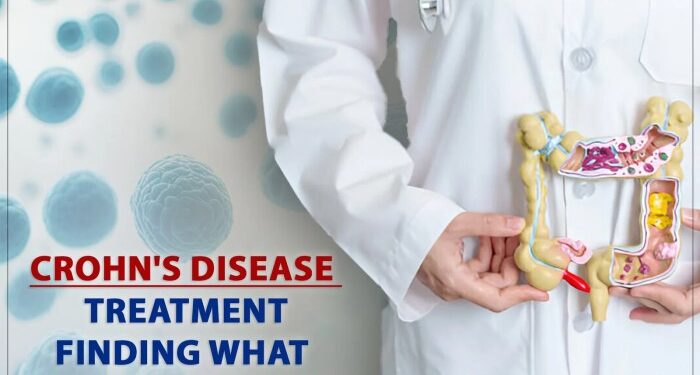 Crohn's Disease Treatment: Finding What Works For You